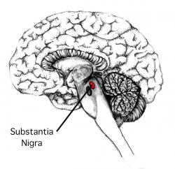 Nejen astronomové, i patologové mají svou „temnou hmotu“ - substantia nigra.  Právě tam se nemocným Parkinsonovou nemocí v neuronech začnou objevovat hnědě zbarvená Lewyho tělíska.