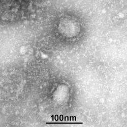 Koronavirus Wuhan na jednom z prvních snímků.