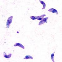 Aktivním stádiím prvoka Toxoplasma se říká tachyzoiti. Svými dlouhými prsty sahají až do našich mozků a nálad. Jistou formu hloupnutí nám nejspíš kompenzují větší odolností před rakovinou. (Kredit: DPDx Parasite Image Library)