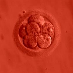 Lidské embryo. 3 dny, 8 buněk. Kredit: ekem / Wikimedia Commons.