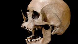 Neolitický „Porsmose man“ z dánského rašeliniště, nalezený se šípem v obličeji. Neolit nebyl idylka. Kredit: National Museum of Denmark/Lund University.