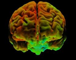 Aktivita v mediálním prefrontálním kortexu mozku vykazuje podobné vzorce u optimisticky zaměřených osob. Zdroj: Nature, Mark a Mary Stevensovi, Neuroimaging and Informatics Institute/SPL Aktivita v mediálním prefrontálním kortexu mozku vykazuje podobné vzorce u optimisticky zaměřených osob. Zdroj: Nature, Mark a Mary Stevensovi, Neuroimaging and Informatics Institute/SPL