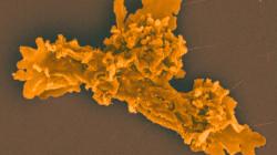 Kolorovaná incediaméba. Kredit: Rappaport et al. (2025), bioRxiv. Kolorovaná incediaméba. Kredit: Rappaport et al. (2025), bioRxiv.