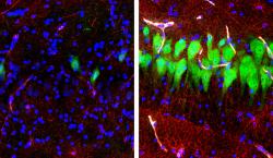 Rozdíl jako facka. Vlevo mrtvý mozek, vpravo mrtvý mozek na BrainExu. Kredit: tefano G. Daniele & Zvonimir Vrselja; Sestan Laboratory; Yale School of Medicine.