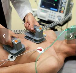 Aplikácia elektrického výboja pri liečbe poruchy rytmu, pacient je v anestéze. (Kredit: Medicinenet)