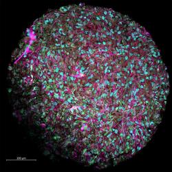 Hartungův minimozek velikosti tečky na i, s 50 tisíci neurony (fialově). Kredit: Jesse Plotkin/Johns Hopkins University.