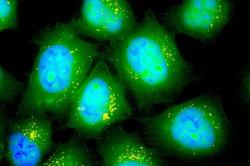 Plicní buňky myší, do nichž v experimentu pronikla mRNA luciferázy. Kredit: Asha Patel.
