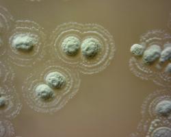 Kolonie nově objevené streptomycety Streptomyces sp.myrophorea. Kredit: G Quinn / Swansea University.