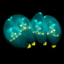 Proslulá toxoplazma. Kredit: Ke Hu & John M. Murray / Wikimedia Commons.