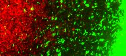 Ultimátní bitva editovaných buněk (zeleně) proti buňkám nádoru (červeně). Kredit: CSTI/Khalid Shah lab.