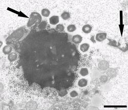 Virová továrna mimiviru Mont1 uvnitř améby, infikovaná virofágem Zamilon (tečky velikosti máku). Kredit: Gaia et al. (2014), PLoS One.