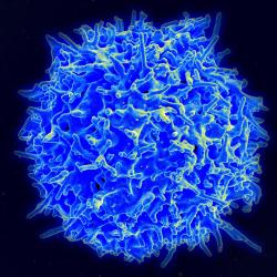 Kolorovaný mikrosnímek lidského T-lymfocytu zdravého člověka Kredit: NIAID, volné dílo