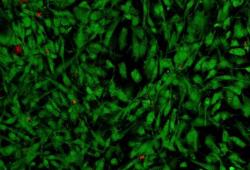 Buňkám v syntetické matrici chrupavky se daří skvěle. Zelené jsou naživu, do mrtvých prostoupilo červené barvivo. To, že červených je více než poskrovnu, je velkým příslibem klinické aplikovatelnosti.  Kredit: Lizhi Xu.  (Kotov lab. University of Michigan).