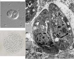VLEVO NAHOŘE: Sporulovaná oocysta Toxoplasma gondii, zvětšeno 100x. (Kredit: Wikimedia Commons, volné dílo).  
VPRAVO: Dva tachyzoity toxoplasmy uzavrené v parazitoforní vakuolární membráně v buňce v plících holuba. (Kredit: Jacques Rigoulet et al., Parasite, 2014, Wikimedia Commons, CC BY 4.0).  
VLEVO DOLE: Tkáňová cysta T. gondii. Uvnitř jsou vidět pomalu se dělící bradyzoiti Kredit: Wikimedia Commons, volné dílo