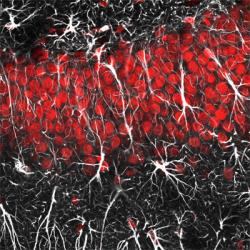 Toto barvení neumožňuje rozlišit jednotlivé typy neuronů, zato je na něm vidět, jak to v mozku vypadá. Neurony jsou doslova „zasíťovány“ bílými astrocyty. (Kredit: Jason Snyder. Licence: CC BY 2.0. Source: https://flic.kr/p/aDcSZ5)