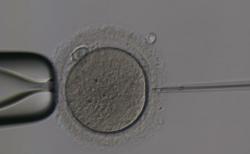 Intracytoplazmatická injekce spermie do vajíčka (ICSI: intracytoplasmic sperm injection). Dnes již ikonický obrázek a synonymum pro IVF (in vitro fertilizace). Skutečnost je poněkud složitější: ICSI je jednou z metod IVF, byť v dnešní době a v některých zemích (včetně České republiky) nejrozšířenější. Původní IVF bylo založené na kultivaci vajíček v přítomnosti spermií; obešlo se tedy bez instrumentária, tj. injekční kapiláry (vpravo), kapiláry pro přidržování vajíčka (vlevo) a mikromanipulátorů (joysticky ovládané kapiláry, eliminující přirozený třes rukou embryologa). Přestožeje ICSI drahé a náročné, jeho obliba má svůj důvod, sice vysokou míru úspěšnosti. Rovněž lze použít nepohyblivé spermie (asthenozoospermia), vyhnout se morfologicky poškozeným spermiím (teratozoospermia) či použít jen nejnižší možný počet spermií (oligozoospermia); tyto problémy by v systému konvenčního IVF byly pro léčbu neplodnosti nepřekonatelnou překážkou.. Autor: Lukáš Gold.