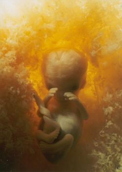 Lidské embryo na konci fáze embryogeneze se svojí vnější podobou blíží naší představě o lidském vzhledu naplňuje naše představy. Opravdu, v 8. týdnu embryonálního vývoje jsou založeny orgánové soustavy a embryo vstupuje do fáze růstu. S respektem k tomuto milníku přestáváme od 9. týdne od oplození mluvit o embryu a začínáme ho označovat jako plod (fetus). Autor: prof. Zbyněk Tonar.