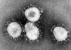 Typické koronaviry. Kredit: CDC/Fred Murphy.