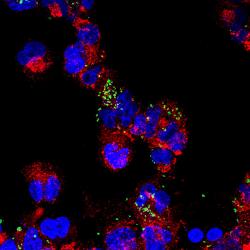 Tularémie (zeleně) útočí na makrofágy. Kredit: Daniel Clemens/Horwitz Lab/UCLA.
