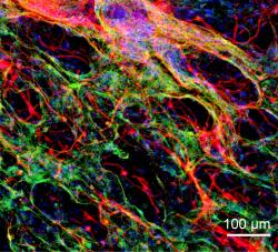 Imunofluorescenční obraz neuronů a astrocytů v transplantovaném hydrogelu Kredit: Satoshi Tanikawa, et al. 14. února 2023)