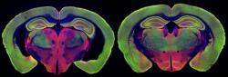 Senzorická stimulace pulzy bílého světla s frekvencí 40Hz světlu zabrzdila neurodegenerativní změny v mozku myši s Alzheimerovou nemocí (vpravo). Pro porovnání vlevo je mozek stejně staré, ale neléčené myši se stejnou genetickou predispozicí. Její mozkové komory se výrazně zvětšily a mozková tkáň atrofovala. Kredit: The Picower Institute (https://picower.mit.edu/discoveries/40hz-rhythms-fight-alzheimers-cellular-and-molecular-level)