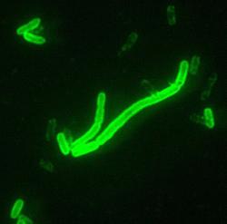 Yersinia pestis, původce moru. Kredit: CDC.