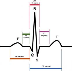 Běžný průběh signálu EKG. Kredit: Agateller (Anthony Atkielski) / Wikimedia Commons.