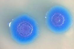 První stabilní polosyntetický organismus - Venterovy mykoplazmy (podrobnosti jeho „umělého života“ zde.  Kredit: J. Craig Venter Institute.