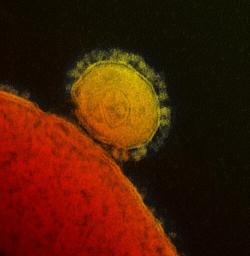 MERS-CoV. Kredit: Wikimedia Commons, National Institute of Allergy and Infectious Diseases, NIH.