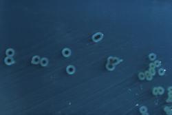 Kolonie salmonel Salmonella enterica serovar Typhimurium na agaru. Kredit: CDC.