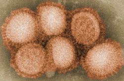 Chřipka H1N1. Kredit: Cybercobra / Wikimedia Commons.
