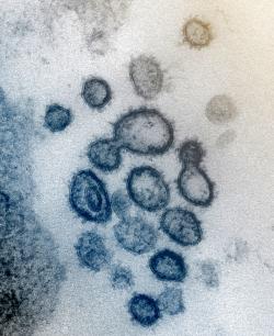 Na snímku pořízeném elektronovým mikroskopem jsou viry SARS-CoV-2 (původci onemocnění COVID-19). Viry mají na vnějším okraji hroty (spike) dávající virům vzezření trnové koruny. Podle toho dostali jméno koronaviry. Kredit: NIAID-RML.
