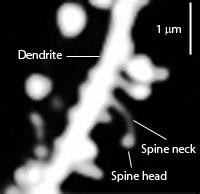 Dendritické trny na povrchu dendritu neuronové buňky ve striatu – důležité součásti bazálních ganglií. Na snímku z laserového skenovacího dvoufotonového mikroskopu lze rozeznat hlavu a krk tenkého (thin) trnu. Kredit: Wikimedia Commons, volné dílo