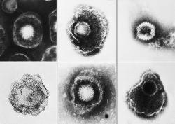 Zlovolné herpesviry. Kredit: CDC/ E. L. Palmer.