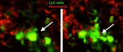 Interakce neutrofilních granulocytů s buňkami myšího Lewisova karcinomu plic vede k blebbingu – k rozvolnění nádorových buněk, pak k jejich segmentaci a pohlcení fagocyty, mezi které patří i neutrofily Kredit: Andrew O. Yam et al, Cancer Research 2023, CC BY-4.0