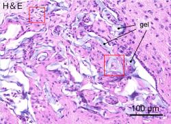 Neurální kmenové buňky 64. den po umístění do hydrogelu transplantovaného v mozku pokusné myši. Červené rámečky označují krevní cévy. Kredit: Satoshi Tanikawa, et al. Scientific Reports. 14. února 2023)