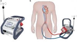 Zariadenie pre podporu krvného obehu Cardiohelp, Maquet Cardiopulmonary AG, umožňujúce  aj režim mimotelovej oxygenácie. (Zařízení Cardiohelp s laskavým svolením Maquet Cardiopulmonary AG).