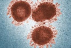 Koronavirus SARS. Kredit: CDC.