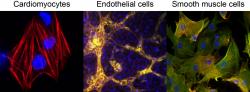 Tri typy buniek, ktoré sú potrebné pre regeneráciu ložiska srdcového infarktu  - kardiomyocyty, tvoriace priečne pruhovanú výkonnú svalovinu srdca, endoteliálne bunky výstelky ciev a bunky hladkej svaloviny cievnej steny sa môžu diferencovať z kardiovaskulárnych progenitorových buniek, ktoré je dnes možne pripraviť aj v laboratóriu. (Kredit: Yu Zhang, Gladstone Institutes)