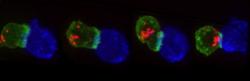 Sekvence snímků buňky zabijáka zachycuje sekreční granule připravující smrtelnou dávku jedu (červeně). Aktinová vlákna (zeleně) je přesunují na frontovou linii, místa odkud zahájí útok na modře zbarvenou rakovinu.