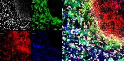 Bitva s kvasinkami. Kolonie kvasinek Candida albicans v myším mozku. Výsadek kvasinek (vpravo nahoře) pod útokem amyloidu beta (červeně) a v obklíčení mikroglií (zeleně). Jádra buněk bíle, astrocyty modře. (9)