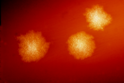 Kolonie Clostridium difficile. Na krevním agaru vypadá hezky a neškodně (Kredit: Dr. Holdeman, Public Health Image Library)