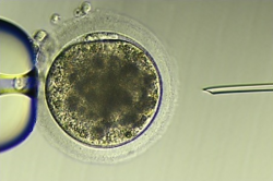 Zralé oslí vajíčko připravené k oplození metodou ICSI. Vajíčko je drženo ve stabilní poloze pipetou (vlevo) a spermie je do něj injikována tenkou kapilárou (vpravo). Průměr vajíčka je něco málo přes desetinu milimetru. Kredit: Andres Gambini