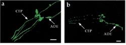 Dopaminergní neurony vystavené vlivu 6-hydroxydomapinu (vlevo) v porovnání s kontrolou (vpravo) .  Zdroj: Nass, R., Hall, D. H., Miller, D. M., & Blakely, R. D. (2002). Neurotoxin-induced degeneration of dopamine neurons in Caenorhabditis elegans. Proceedings of the National Academy of Sciences, 99(5), 3264-3269.