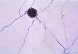 Kropidlák (Aspergillus niger). Na kulovitém měchýřku (cca 20-30 µm) vyrůstají řetízky konidií.