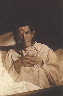 Auguste Deter (1850 – 1906), pacientka, na jejímž případu Alois Alzheimer popsal chorobu, která po něm byla později pojmenována. (Wikipedie, volné dílo).