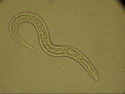 Hádě střevní (Strongyloides stercoralis). Délka 0,8 – 2,2 mm. (Kredit: Hospital for Tropical Diseases, London, UK).