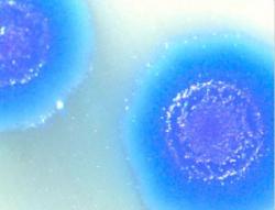 Kolonie bakterií Mycoplasma mycoides. Kredit: J. Craig Venter Institute