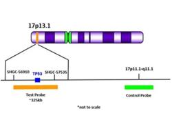 Gen TP53 je gen kódující protein p53, přezdívaný "strážce genomu". Mutace v tomto genu jsou nejčastější genetickou abnormalitou u lidských nádorů a vedou k zvýšenému riziku rakoviny, včetně Li-Fraumeniho syndromu.  Gen máme na kratším raménku chromozomu č. 17. Kredit: Biocare Medical. https://biocare.net/