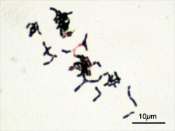 Bifidobacterium je celý rod anaerobních bakterií. Dříve se jim říkalo laktobacily. Některým, jako třeba B. Dentium, je lepší se vyvarovat, neboť se stará o to, aby zubní lékaři měli co dělat. Jiné z bifidobakterií se používají jako probiotika. Na snímku je Bifidobacterium adolescentis. Zvětšeno 1000krát. Autor: Y tambe, Wikipedia, CC BY-SA 3.0